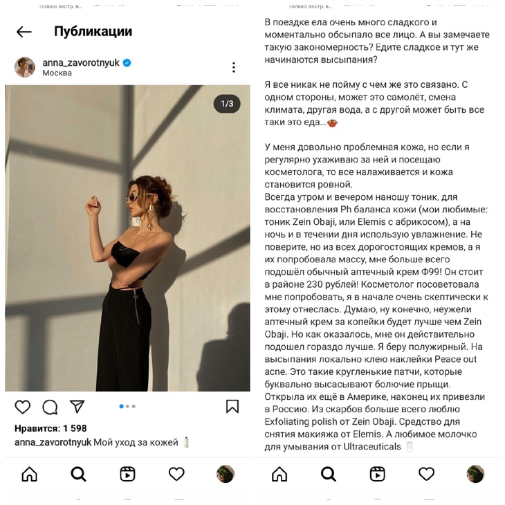  «Моментально обсыпало все лицо» : дочь Заворотнюк не может есть сахар