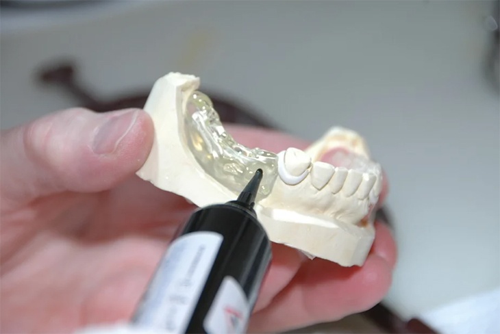 «Причина запаха»: стоматолог объяснила, чем грозят протезы и брекеты