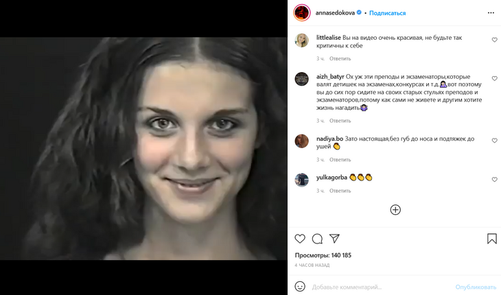 Седокова показала себя «без губ до носа и подтяжек до ушей»: видео