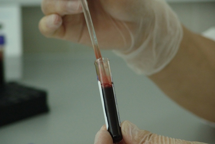 Злейший враг крови: гематолог рассказал, от каких продуктов образуются тромбы