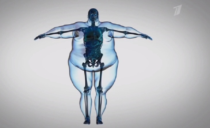 10 процентов от веса: Малышева раскрыла, может ли «широкая кость» быть причиной лишнего веса