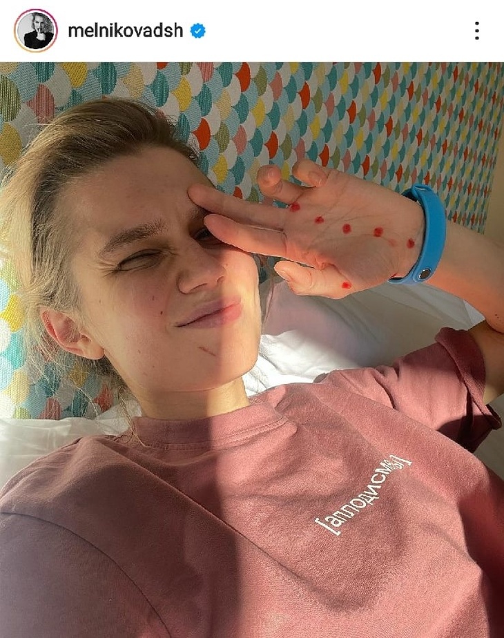 «Вторые сутки пластом»: Дарью Мельникову сразила болезнь