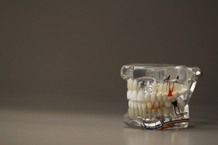 Стоматолог назвал страшные последствия отказа от имплантации зубов