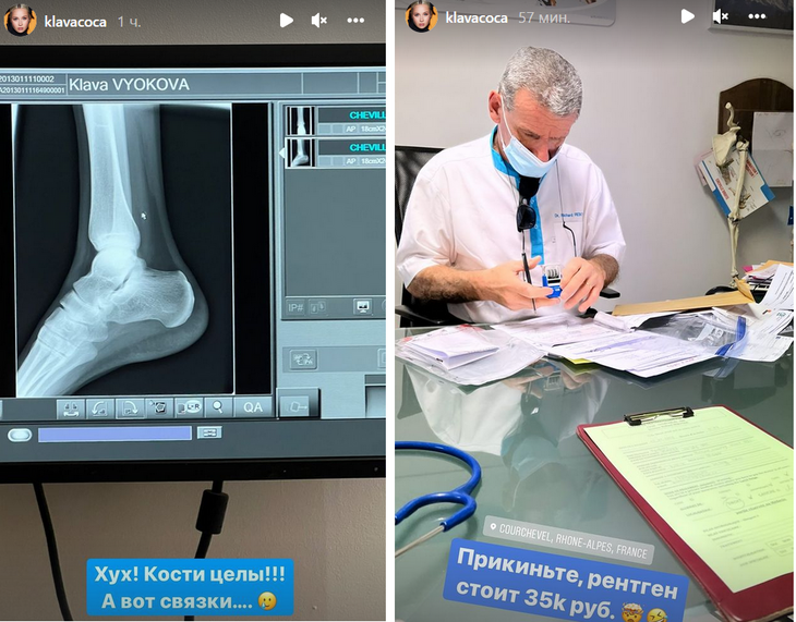 Клава Кока разбилась на сноуборде в Куршевеле: видео