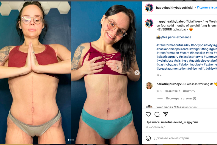 Девушка показала шокирующие фото ее груди после похудения на 135 кг