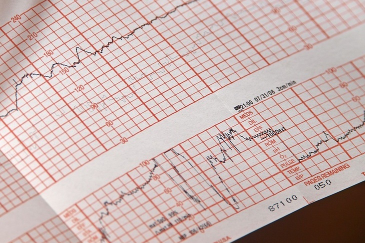 «Можем отследить изменение ритма»: кардиолог объяснил, как часто следует проходить ЭКГ