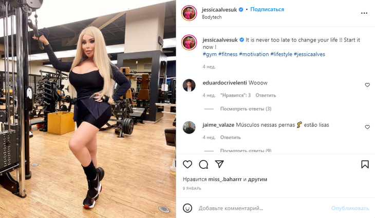 Ставший женщиной «живой Кен» Родриго Алвес пожаловался на дискриминацию 