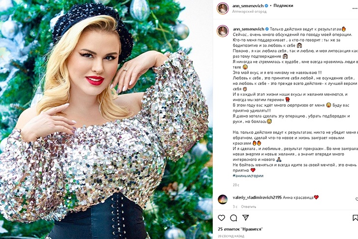 «Во мне заиграли новые желания»: Семенович призналась, что сделала липосакцию из любви к себе