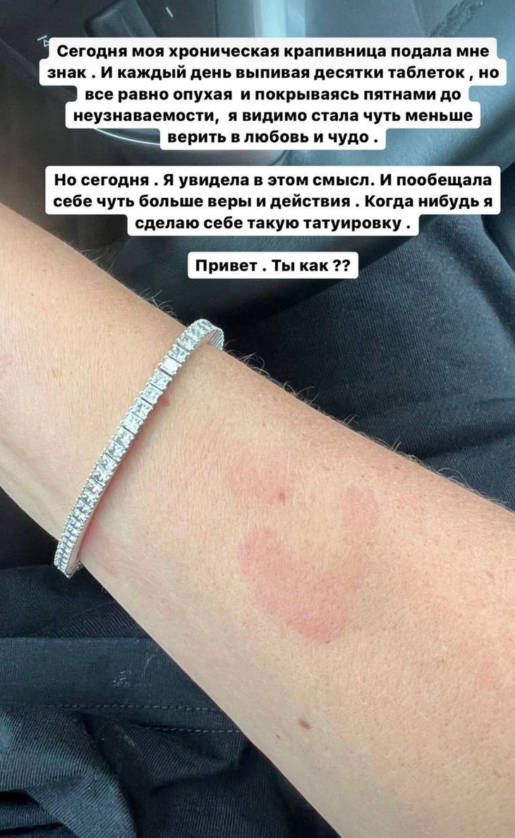 «Каждый день выпиваю десятки таблеток»: Седокова тяжело заболела