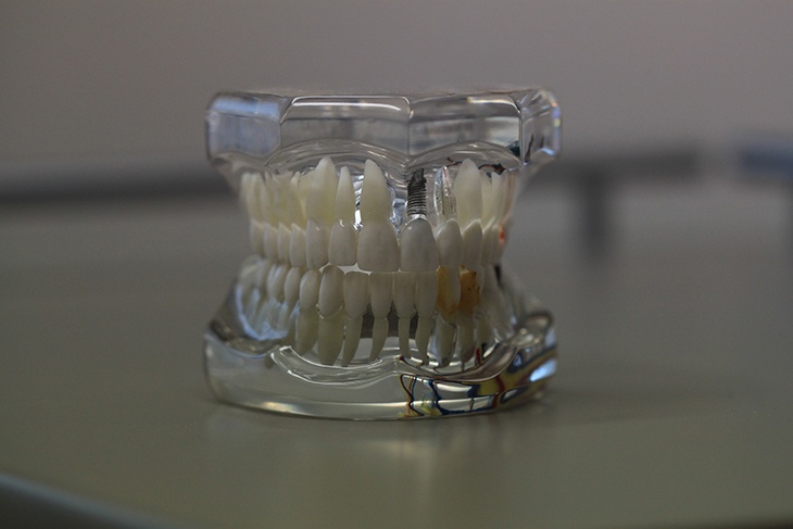 Не выпадает: в программе Мясникова рассказали о новом зубном чудо-протезе