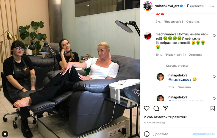 «Безобразные стопы»: Волочкову распекли за фото «покореженных» ног