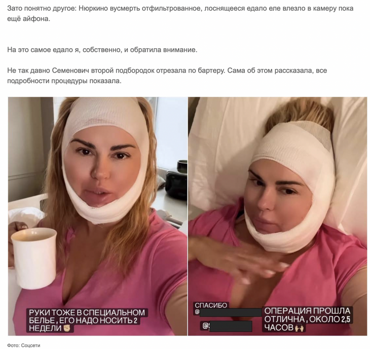 «Лоснящееся едало еле влезло в камеру»: Миро не поняла, зачем Семенович отрезала подбородок