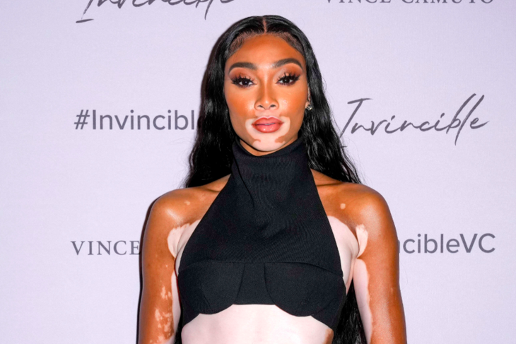 Winnie Harlow WOWS her toned legs and flat belly in open dress
