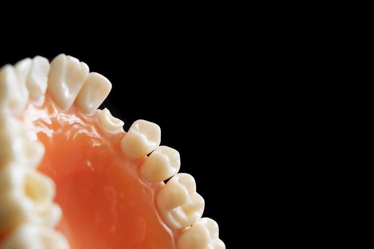 Стоматолог назвал продукты, разрушающие эмаль зубов