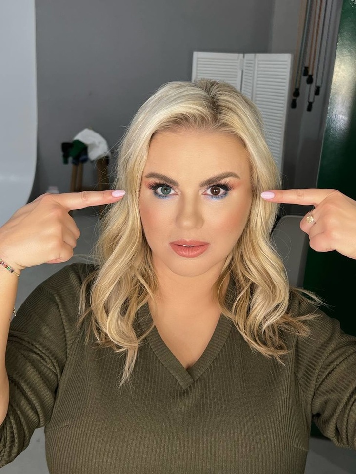 У Анны Семенович гетерохромия: фото