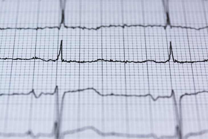 Кардиолог перечислил главные причины остановки сердца