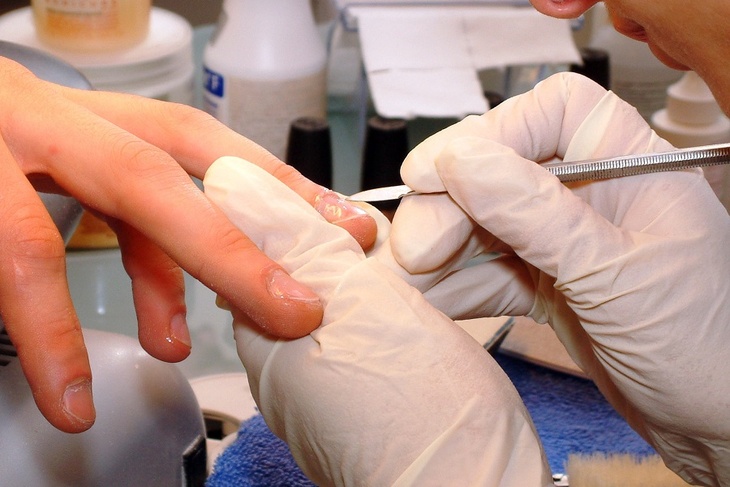 Как по ногтям определить болезни человека ― дерматологи