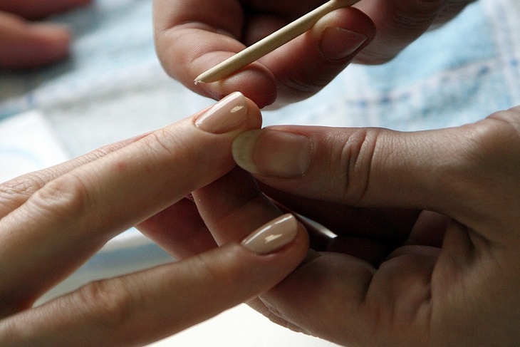 Дерматолог рассказала о связи между расслоением ногтей и средствами для снятия лака