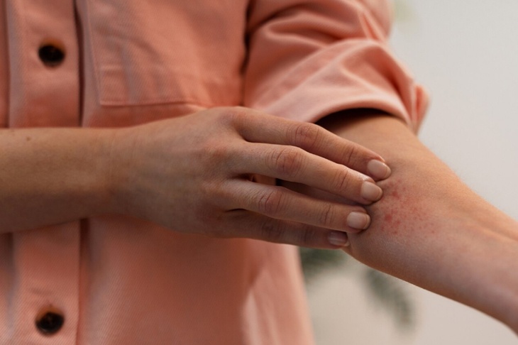 Врач раскрыла, на какие опасные заболевания указывают пигментные пятна