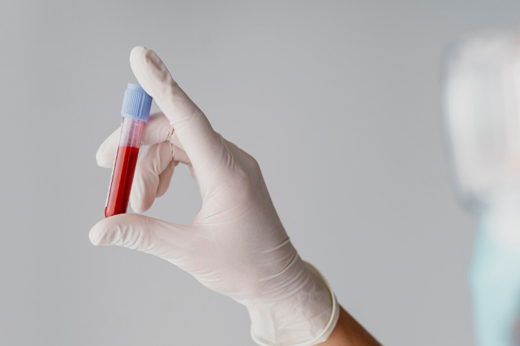 Россиянам рассказали, какие анализы важно сдать после январских каникул 