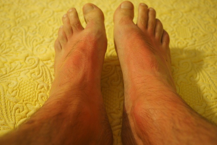 Судороги в ногах ночью: причины и профилактика